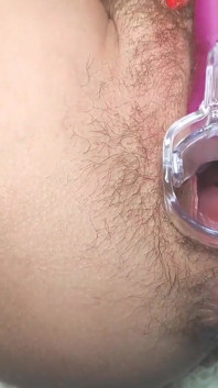Orgasme dalam rakaman dekat semasa pepek terbuka menggunakan spekulum
