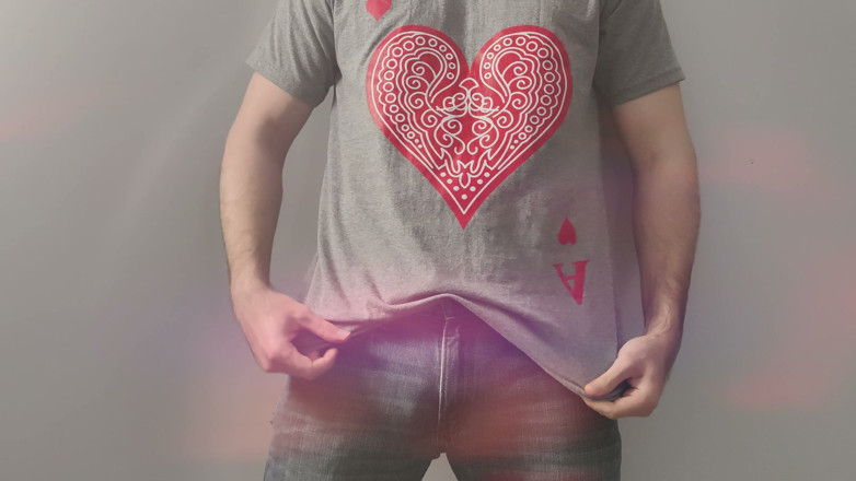 Albino Adonis (Gay): Strip Please Series: Chroma Lens Flare