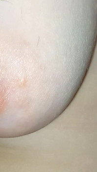 Hairy Breasts