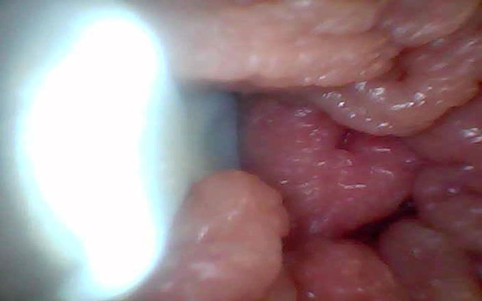 Twittiy: La videocamera endoscopica mostra le parti più sensibili del pene...