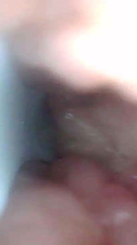 Endoskopová kamera ukazuje nejcitlivější části vzdělávacího videa penisu