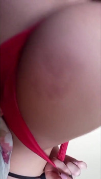 My Butt Cheek Got Purple From a Spanking