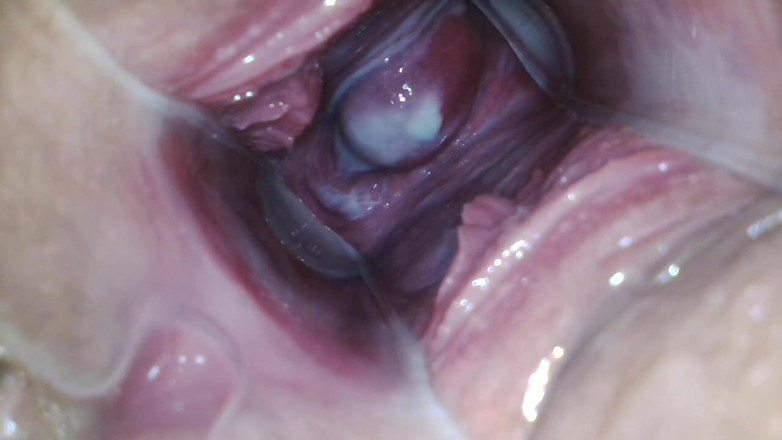 JANA studios: Endoscope in my pussy