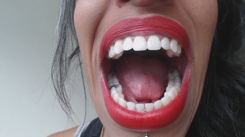 Mouth Viewing (Golden lace) Mouth Viewing (Golden lace)