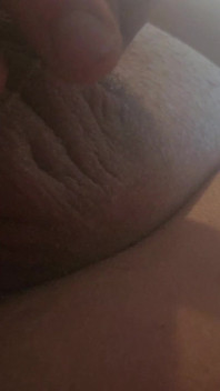 Penis