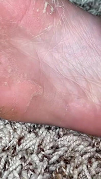 Fußpeeling und Massage von Ivys Füßen