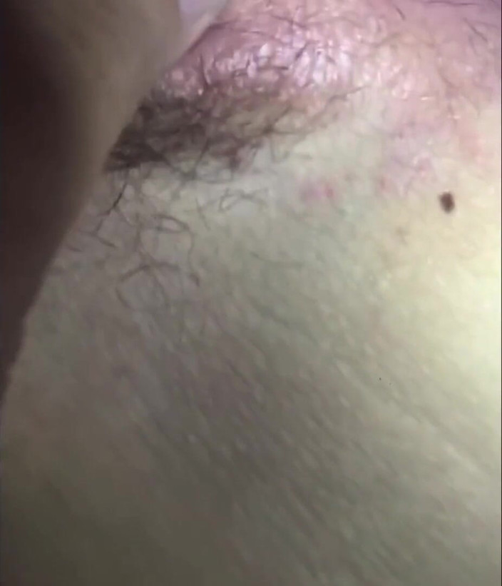 Hashini Hirunika: Menjolok bahagian 2