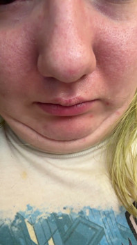 Chin Faces