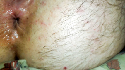 TboyCodyLee: (plná verze) FTM chlapec má zničený zadek! - 4k