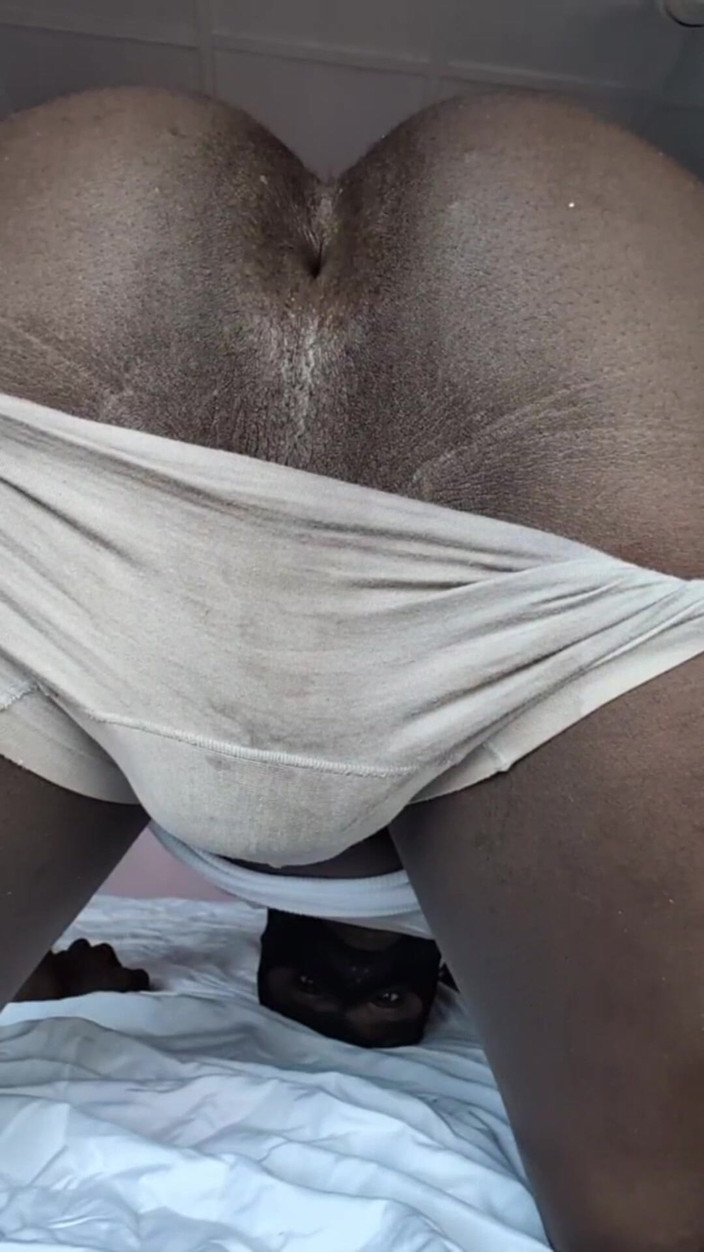 Melaninfling: Redare