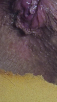 Pushing Out a Creampie