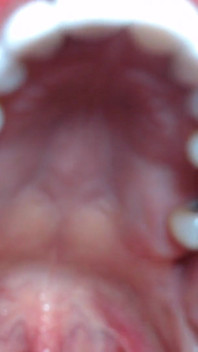 Tour The Terrors in my Mouth