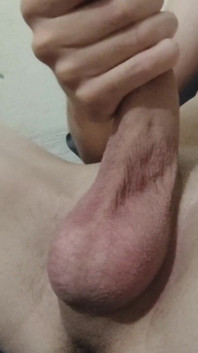 Sụt cu nóng bỏng