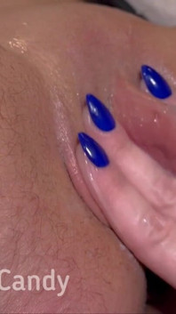 Big Clit Ftm