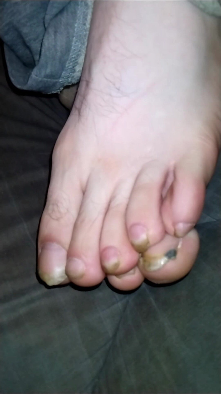 Au79: Foot Fancies