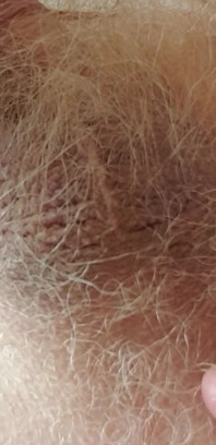 Very Small Cock
