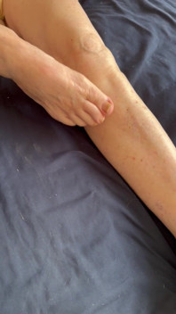 Bare Feet and Legs