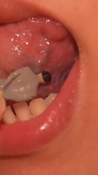 巨人嘴巴特写娇小丈夫面对他最大的恐惧