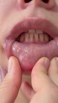 My Stepsister Does Tongue Fetish and Plays with Her Mouth and Then Shows Her Teeth