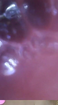 Endoscopy!! Giantess Swallowed a 25 Members at Same Time