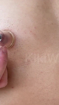 Asian Ftm Oiled Closeup Nipple Pussy Pumping and Cupping