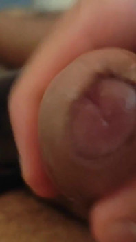 Great Phimosis Getting in the Way of the Boy's Orgasm
