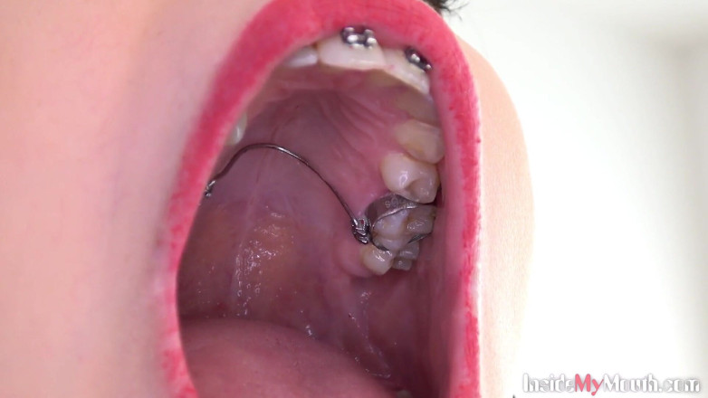Inside My Mouth: Video fetish della bocca con Bara che mostra l'apparecchio dentale.