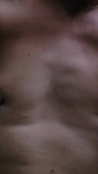 Dengan Nipple Suckers