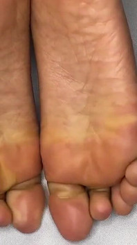 Renda meia-calça francesa Pedicure