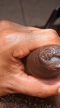 Pancut ke dalam Foreskin