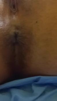 Showing Pussy and Asshole