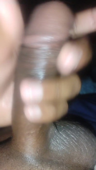 1000017835