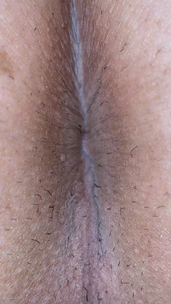 Caratteristica speciale del buco del culo dell'uomo - video specializzato in ano in cui le rughe di ano possono essere viste chiaramente.