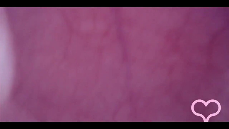 Lina Free: Amımdan sikiliyor, mesanemde kamera, çılgın şişkinlik!