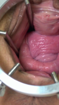 Más Fisting, Doble Y Espéculo. Completo