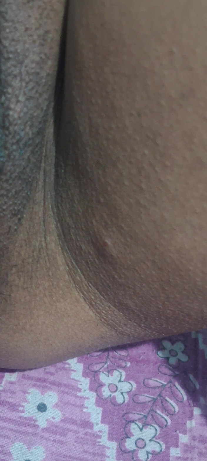 Localsexlove011: Indiandesi Assam Girl Show Hairy Pussy