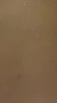 My Puffy Nipples Are Very Close