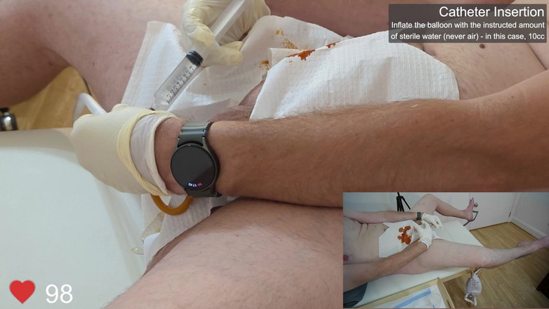 Clinical Climax: Catheter प्रविष्टि