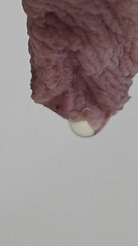 足に小便