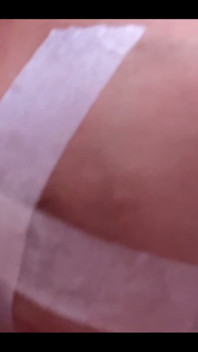 My Boob Is About to Explode