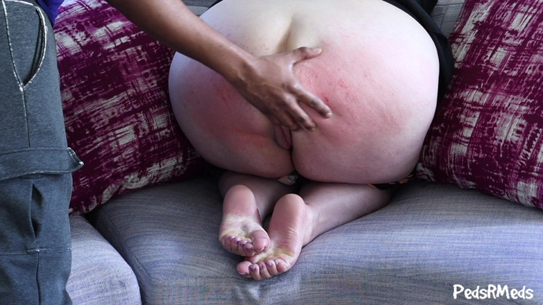 PedsRMeds: Shortlivedtyranny Bare Ass Spanking