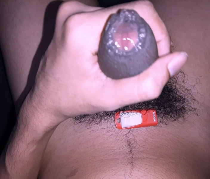 Hot Kolla: Cậu bé dễ thương sụt cu