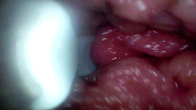 Ladybottox: Kamera Endoscope merakam G Spot Isteri Saya. Video Pendidikan Rakaman...