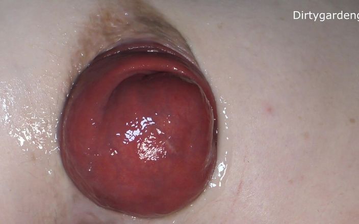 Dirtygardengirl VOD: More Anal Spreader