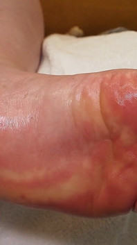 Look in Silence: My Foot and Massage