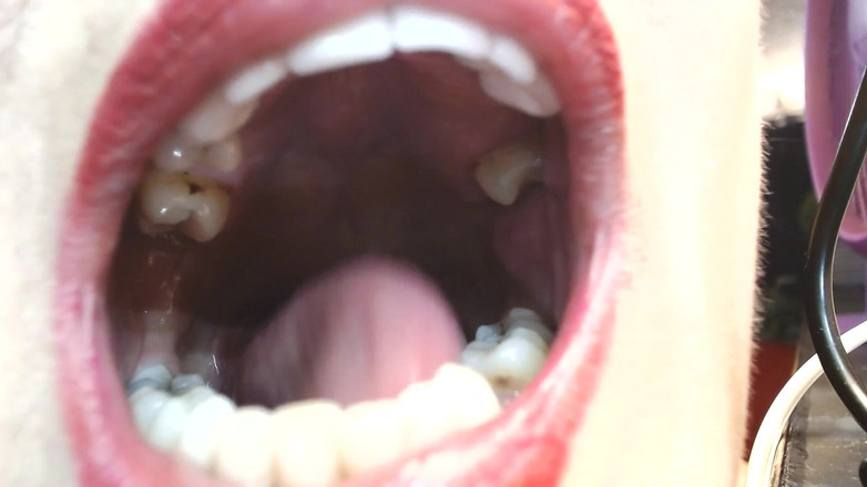 Abby Anna: Dentro da minha úvula dos dentes da língua da boca grande