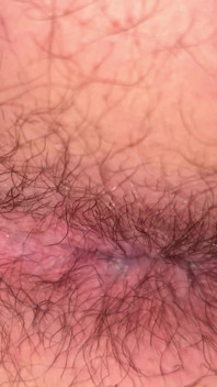 Close up Hairy Hole