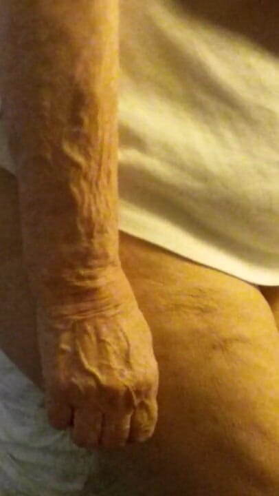 BBW nurse Vicki adventures with friends: Awek Belanda seksi menghisap hidungnya dengan pantat bogel