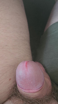 Twitching the Peen