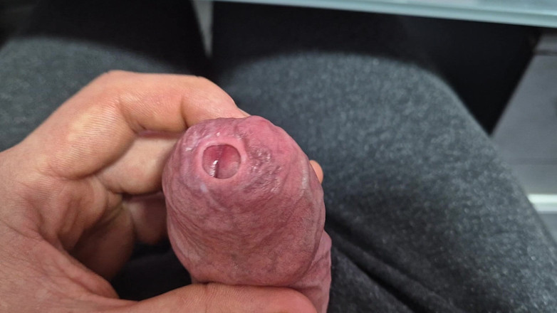 GloomyChase977: Uncut Tight Phimosis Cock Precum Tease for Foreskin Lovers with...